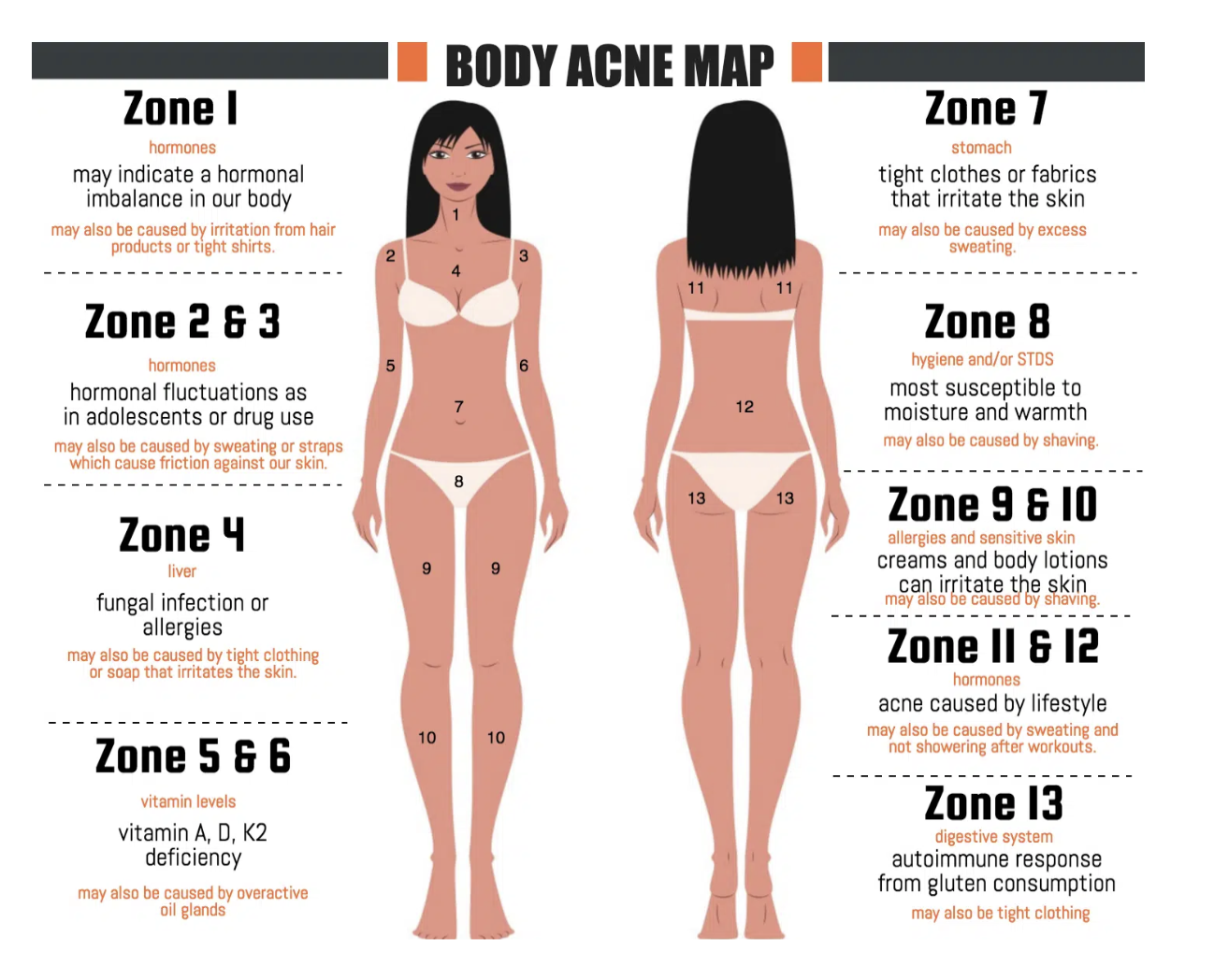 body acne map